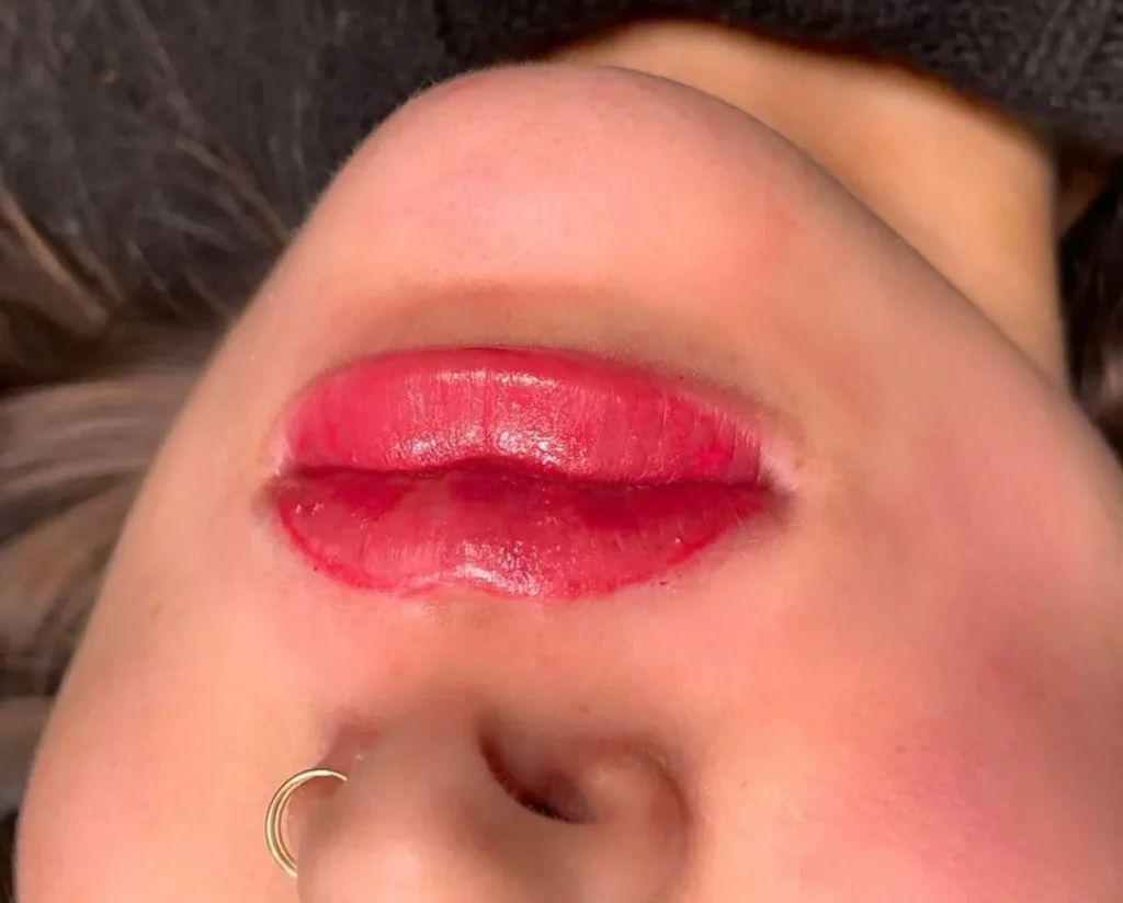 lips after lip tattooing